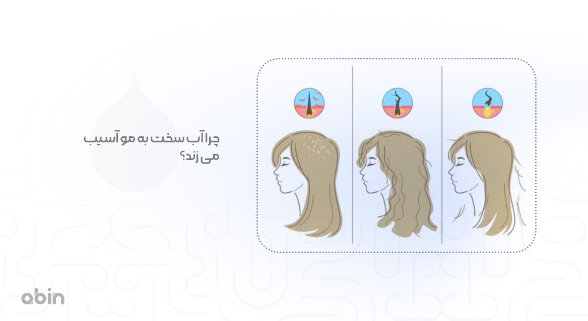 چرا آب سخت به مو آسیب می زند؟