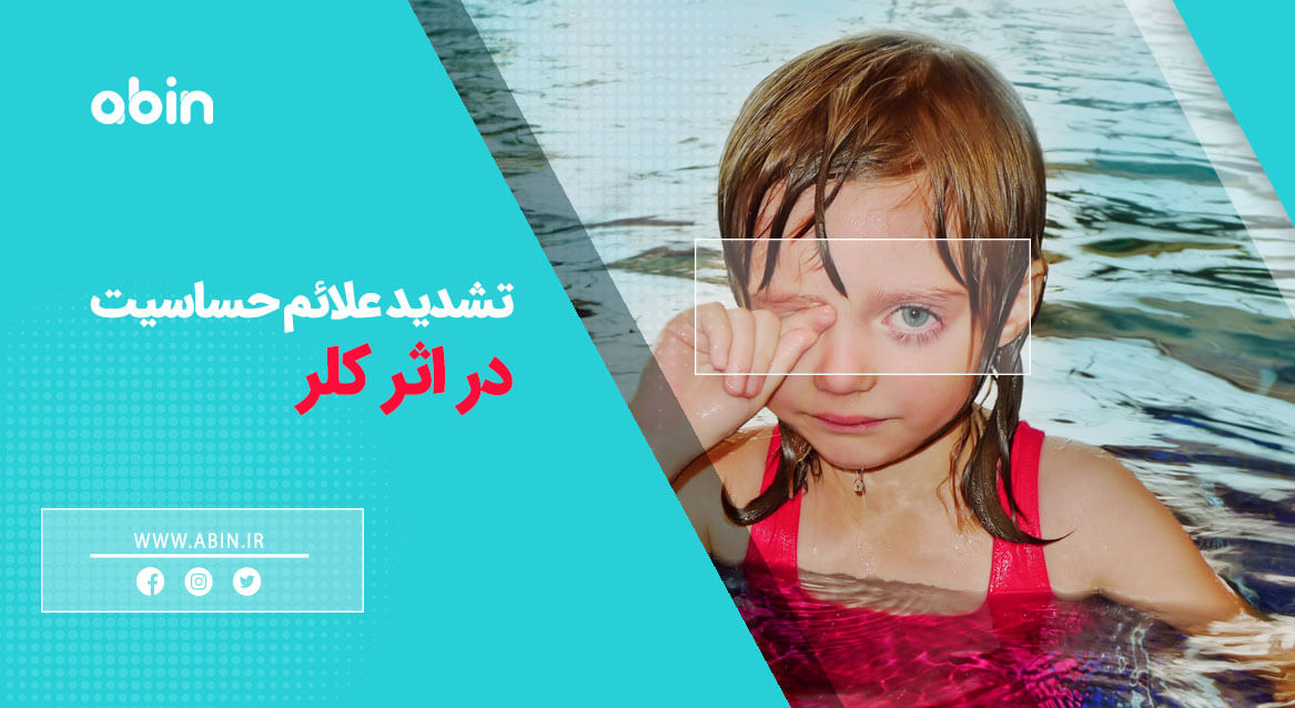 علائم حساسیت در اثر کلر